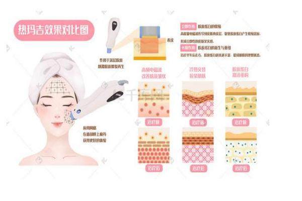 5d膠原光和熱瑪吉哪個好