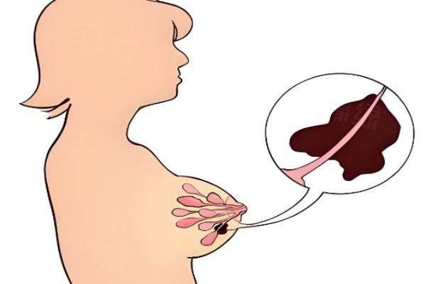 山東臨沂衛(wèi)康醫(yī)院王秀紅縮胸手術(shù)咋樣