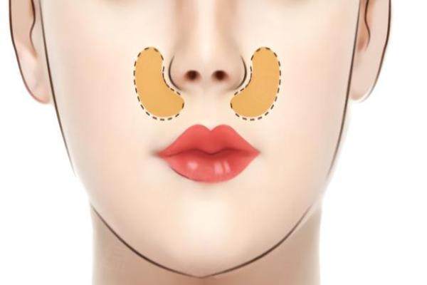 鼻子整形咨 詢要咨 詢些什么