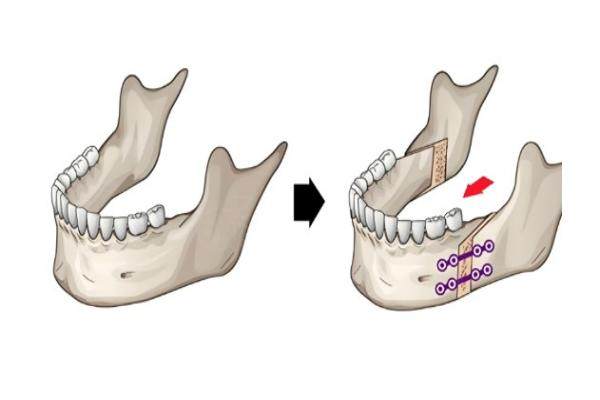 南京吳國(guó)平做手術(shù)好嗎
