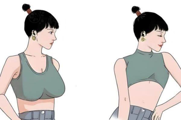 山東臨沂衛(wèi)康醫(yī)院王秀紅縮胸手術(shù)咋樣