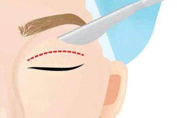 成都雙眼皮修復(fù)醫(yī)院排名介紹