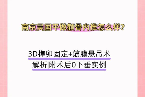 南京吳國平做顴骨內(nèi)推怎么樣