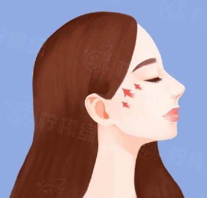 南京吳國平做顴骨內(nèi)推怎么樣