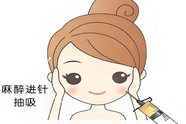 蘇州紫馨陳云娟醫(yī)生怎么樣