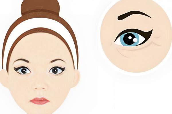 北京師麗麗雙眼皮修復實例