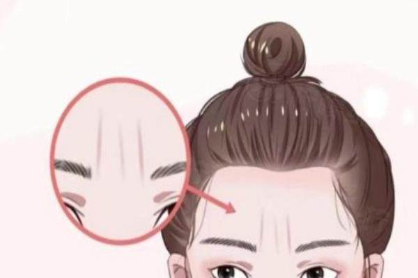 濟南哪家醫(yī)院做川字紋手術(shù)好