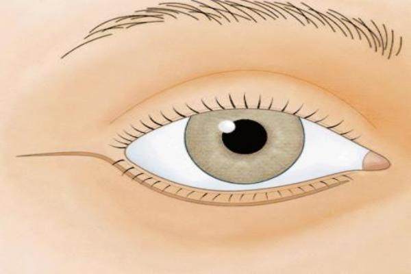 重慶華美陳凱修復(fù)眼睛自然成功實(shí)例,重慶華美李富強(qiáng)實(shí)例,重慶華美谷琪實(shí)例