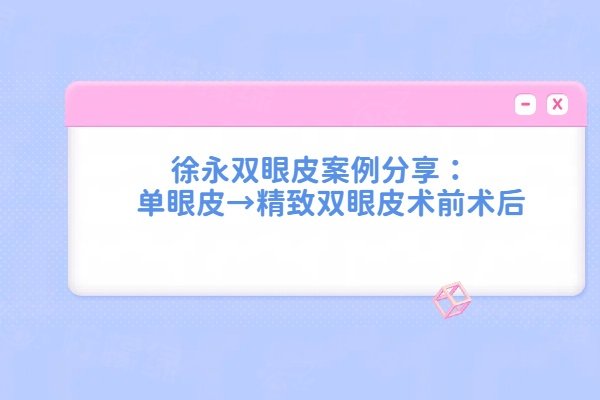 濟(jì)南海峽醫(yī)院徐永雙眼皮實例分享