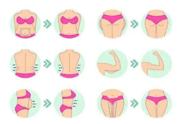 張春彥醫(yī)生吸脂技術怎么樣