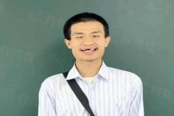 韋神牙齒脫落引熱議