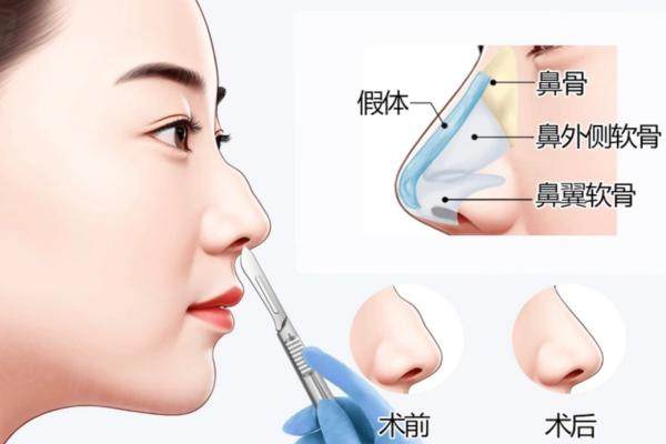 沈陽曙光整形外科車金昊失敗實(shí)例修復(fù)