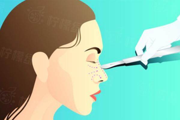 沈陽名流王松實(shí)例