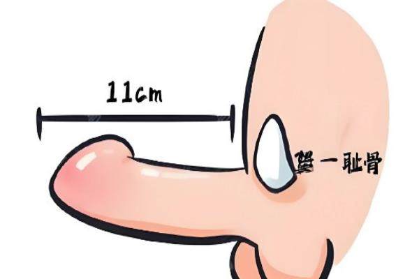 石家莊雅芳亞醫(yī)療美容醫(yī)院做男士私密手術(shù)多少錢