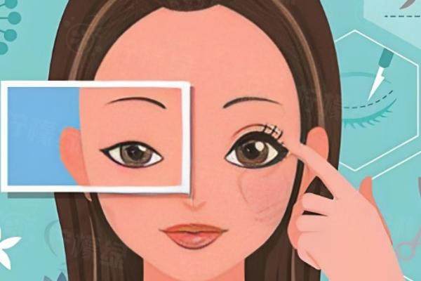 任曉東眼修復(fù)收費(fèi)標(biāo)準(zhǔn)