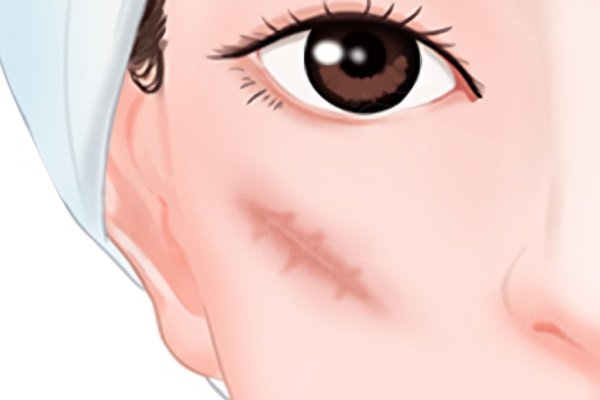 國內(nèi)疤痕修復(fù)醫(yī)院排名前十