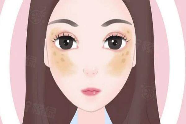 激光祛斑價(jià)格表