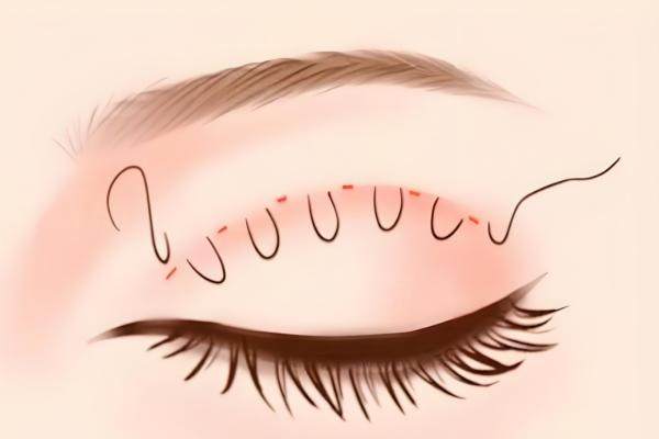 合肥周瑜醫(yī)生反饋