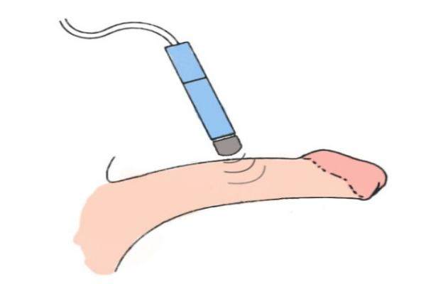 杭州做男性私密手術醫(yī)院排名前三名