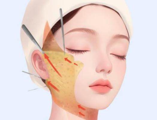 哈爾濱雙燕醫(yī)美做拉皮醫(yī)生是誰(shuí)