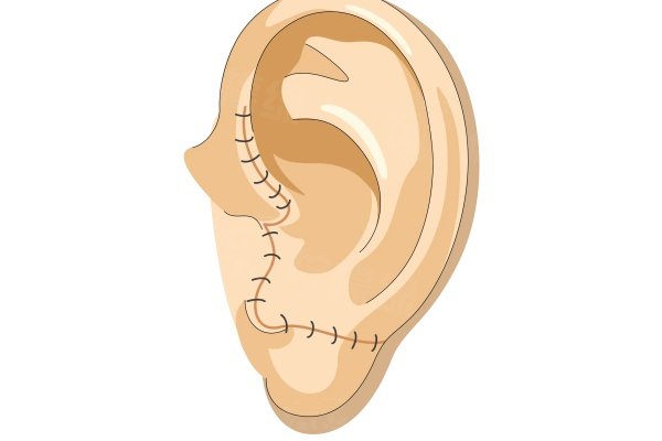 重慶做耳朵整形的醫(yī)院排名