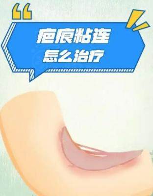 淄博疤痕修復(fù)醫(yī)院哪家好