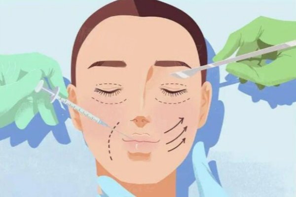 國(guó)內(nèi)顴骨整形有名的醫(yī)院排