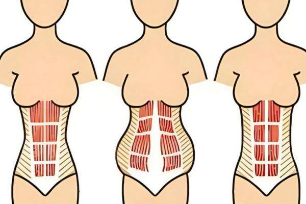 腹壁整形手術醫(yī)生排名榜