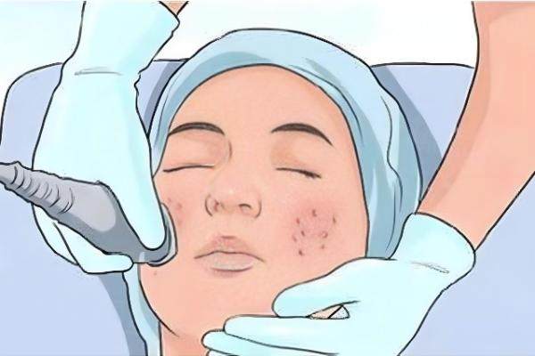 臺(tái)州藝星醫(yī)院做皮膚激光多少錢