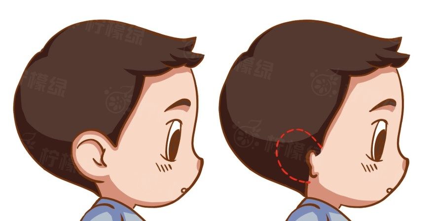 北京耳朵整形醫(yī)生哪個(gè)好