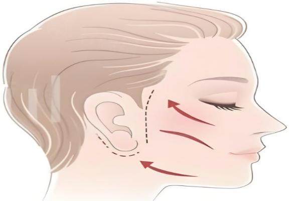 山東做拉皮手術(shù)好的醫(yī)生排名前十