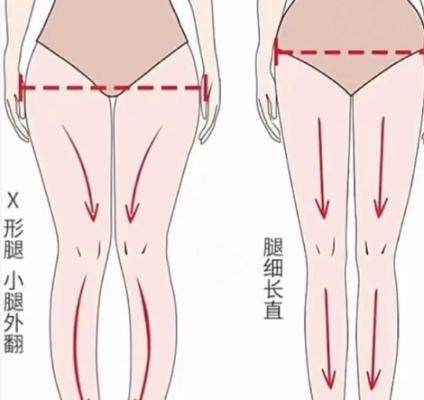 國(guó)內(nèi)腿型矯正醫(yī)院哪家好