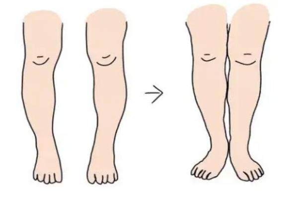 國(guó)內(nèi)腿型矯正醫(yī)院排行榜