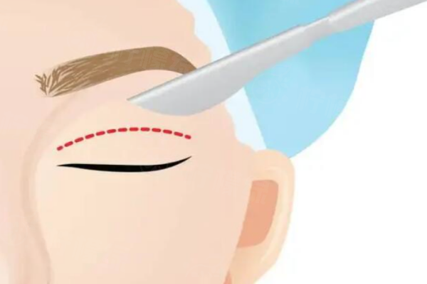 大連劉志剛雙眼皮修復(fù)<span style=