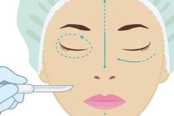 大連劉志剛雙眼皮修復(fù)<span style=