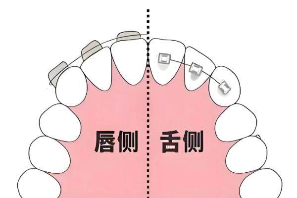 徐子卿正畸很厲 害嗎