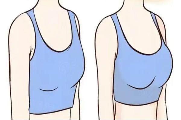 脂肪移植豐胸醫(yī)生韋元強口碑怎么樣