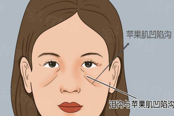 王闊遠(yuǎn)醫(yī)生面部減容實(shí)例