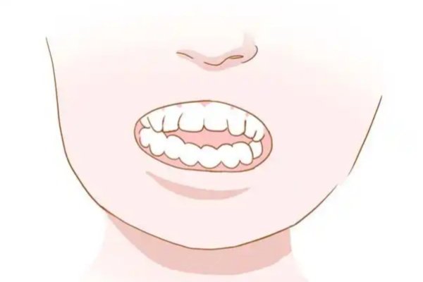 深圳正畸醫(yī)生推薦