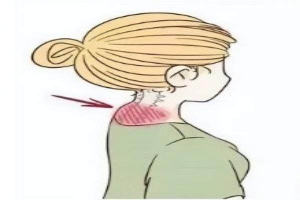 北京做富貴包醫(yī)院推薦