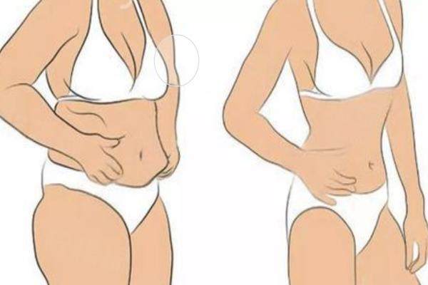 唐山蘇亞美聯(lián)臣整形醫(yī)院吸脂技術(shù)怎么樣