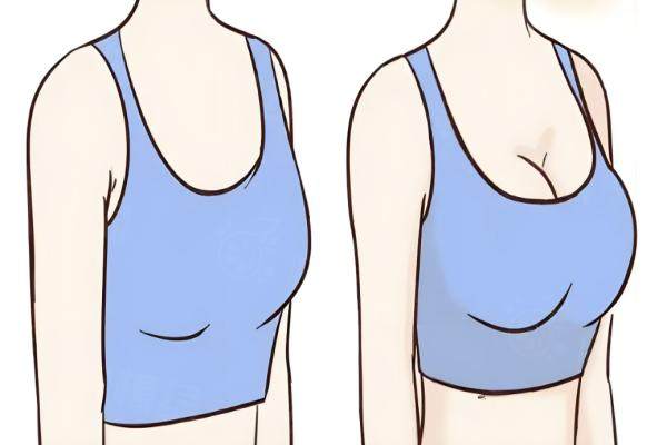 ?？邬i愛醫(yī)療美容隆胸多少錢