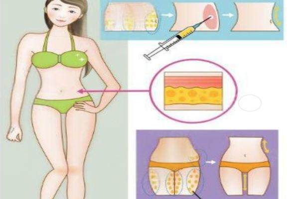 陳三群做人魚藝術(shù)體雕怎么樣