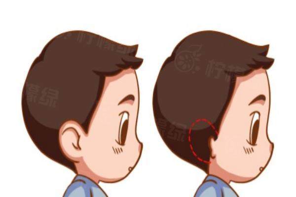 北京小耳畸形醫(yī)院有哪些