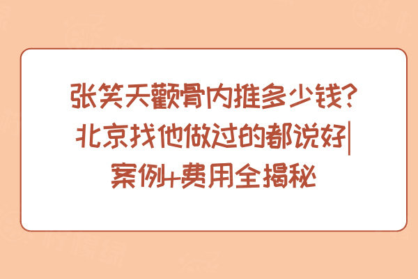 張笑天顴骨內(nèi)推多少錢