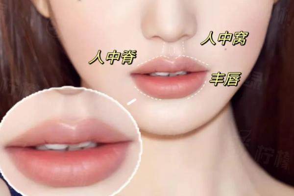 上海盧九寧人中縮短術(shù)評(píng)價(jià)