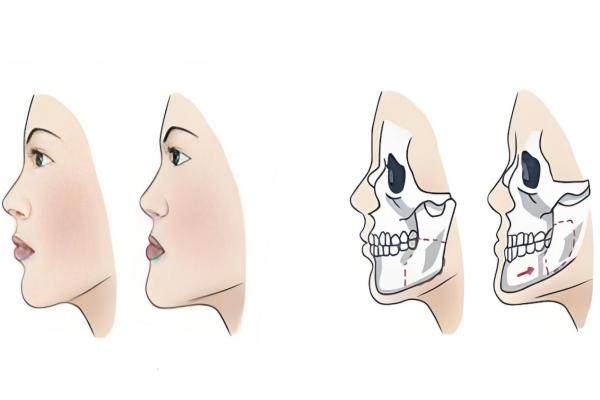 樸正國(guó)醫(yī)生在哪個(gè)醫(yī)院坐診