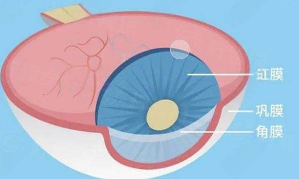 烏魯木齊普瑞眼科醫(yī)院做晶體植入多少錢