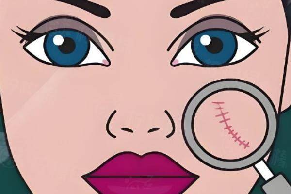 北京廣濟醫(yī)院疤痕科掛號