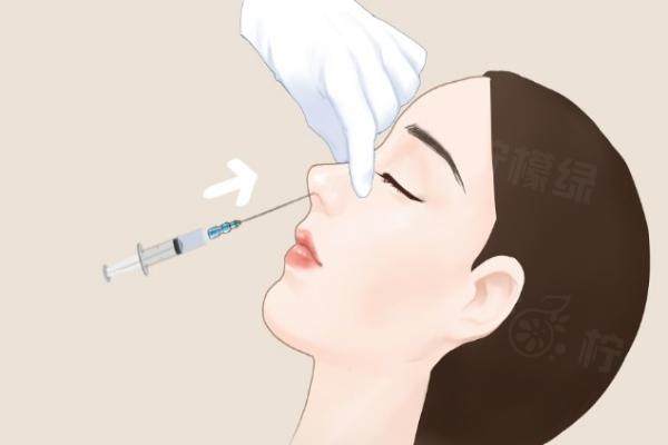 優(yōu)法蘭填充鼻子價格